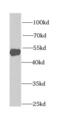 Chitinase Acidic antibody, FNab01650, FineTest, Western Blot image 