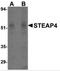 STEAP4 Metalloreductase antibody, 4313, ProSci, Western Blot image 