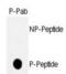 p53 antibody, abx031899, Abbexa, Immunohistochemistry paraffin image 
