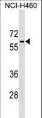 Phosphoglucomutase 5 antibody, LS-C158583, Lifespan Biosciences, Western Blot image 