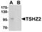 Teashirt Zinc Finger Homeobox 2 antibody, orb75764, Biorbyt, Western Blot image 