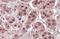 Karyopherin Subunit Alpha 6 antibody, NB100-93456, Novus Biologicals, Immunohistochemistry paraffin image 