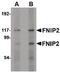 Folliculin Interacting Protein 2 antibody, PA5-20690, Invitrogen Antibodies, Western Blot image 