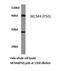 Minichromosome Maintenance Complex Component 4 antibody, LS-C177430, Lifespan Biosciences, Western Blot image 