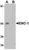 Ectodermal-Neural Cortex 1 antibody, orb75400, Biorbyt, Western Blot image 