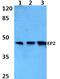 Prostaglandin E Receptor 2 antibody, GTX66688, GeneTex, Western Blot image 