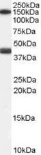 Galanin Receptor 1 antibody, PA5-18628, Invitrogen Antibodies, Western Blot image 