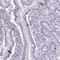 Zinc Finger Protein 334 antibody, HPA050022, Atlas Antibodies, Immunohistochemistry paraffin image 