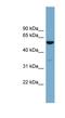 Actin Related Protein 10 antibody, NBP1-56886, Novus Biologicals, Western Blot image 