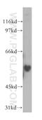 KH RNA Binding Domain Containing, Signal Transduction Associated 3 antibody, 13563-1-AP, Proteintech Group, Western Blot image 