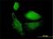 VAMP1 antibody, H00006843-M02, Novus Biologicals, Immunofluorescence image 