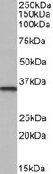 Proprotein Convertase Subtilisin/Kexin Type 9 antibody, 42-463, ProSci, Enzyme Linked Immunosorbent Assay image 