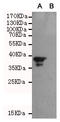 BCL2 Associated Athanogene 1 antibody, STJ99243, St John