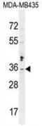 Metaxin 2 antibody, AP52772PU-N, Origene, Western Blot image 