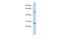 BTB Domain Containing 2 antibody, A13143, Boster Biological Technology, Western Blot image 