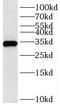 Thioredoxin-related transmembrane protein 2 antibody, FNab08812, FineTest, Western Blot image 