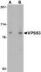 VPS53 Subunit Of GARP Complex antibody, LS-C53295, Lifespan Biosciences, Western Blot image 