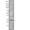 RAB5B, Member RAS Oncogene Family antibody, abx218131, Abbexa, Western Blot image 