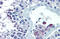 SET1 antibody, 25-188, ProSci, Enzyme Linked Immunosorbent Assay image 