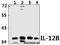 Interleukin 12B antibody, GTX66713, GeneTex, Western Blot image 