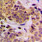 Protein Tyrosine Phosphatase Non-Receptor Type 11 antibody, LS-C354075, Lifespan Biosciences, Immunohistochemistry paraffin image 