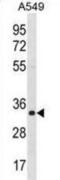 Enoyl-CoA Hydratase 1 antibody, abx030420, Abbexa, Western Blot image 