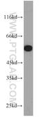 Serine/Threonine Kinase 4 antibody, 22245-1-AP, Proteintech Group, Western Blot image 