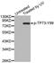 Tumor Protein P73 antibody, MBS128366, MyBioSource, Western Blot image 