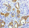 EGFR antibody, LS-C796752, Lifespan Biosciences, Immunohistochemistry paraffin image 