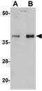 Phospholipid Phosphatase 7 (Inactive) antibody, GTX31978, GeneTex, Western Blot image 
