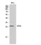 CMTM4 antibody, GTX34320, GeneTex, Western Blot image 