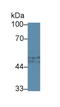 Serpin Family G Member 1 antibody, LS-C293466, Lifespan Biosciences, Western Blot image 