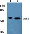 Solute Carrier Family 2 Member 2 antibody, A02297, Boster Biological Technology, Western Blot image 