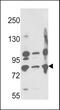 Membrane Metalloendopeptidase antibody, MBS9208256, MyBioSource, Western Blot image 