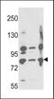 Membrane Metalloendopeptidase antibody, MBS9208256, MyBioSource, Western Blot image 