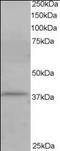 Cytohesin 1 Interacting Protein antibody, orb95848, Biorbyt, Western Blot image 