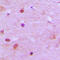 Regulator Of Chromosome Condensation 2 antibody, LS-C353491, Lifespan Biosciences, Immunohistochemistry paraffin image 