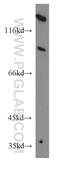 IRP1 antibody, 12406-1-AP, Proteintech Group, Western Blot image 