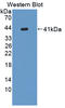 Keratin 6C antibody, LS-C374773, Lifespan Biosciences, Western Blot image 
