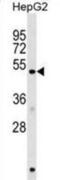 Homocysteine Inducible ER Protein With Ubiquitin Like Domain 1 antibody, abx029371, Abbexa, Western Blot image 