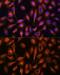 Spectrin Alpha, Non-Erythrocytic 1 antibody, GTX66033, GeneTex, Immunocytochemistry image 