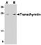 Transthyretin antibody, orb75196, Biorbyt, Western Blot image 