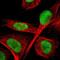 Tousled Like Kinase 1 antibody, NBP1-83035, Novus Biologicals, Immunofluorescence image 