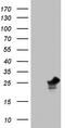 Platelet Activating Factor Acetylhydrolase 1b Catalytic Subunit 3 antibody, M07650, Boster Biological Technology, Western Blot image 