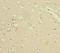 Vacuolar protein sorting-associated protein 33B antibody, LS-C676705, Lifespan Biosciences, Immunohistochemistry paraffin image 