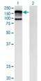 CAP-Gly Domain Containing Linker Protein 2 antibody, H00007461-M07, Novus Biologicals, Western Blot image 