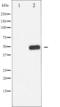 Calcium/Calmodulin Dependent Protein Kinase II Alpha antibody, GTX52346, GeneTex, Western Blot image 