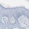 Carbonic Anhydrase 3 antibody, HPA021775, Atlas Antibodies, Immunohistochemistry frozen image 