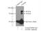 Zinc Finger Protein 606 antibody, 26128-1-AP, Proteintech Group, Immunoprecipitation image 