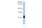 Ras Homolog Family Member D antibody, GTX47031, GeneTex, Western Blot image 